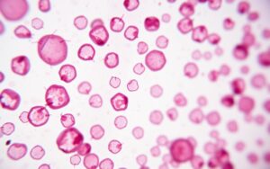 neutrofile poniżej normy